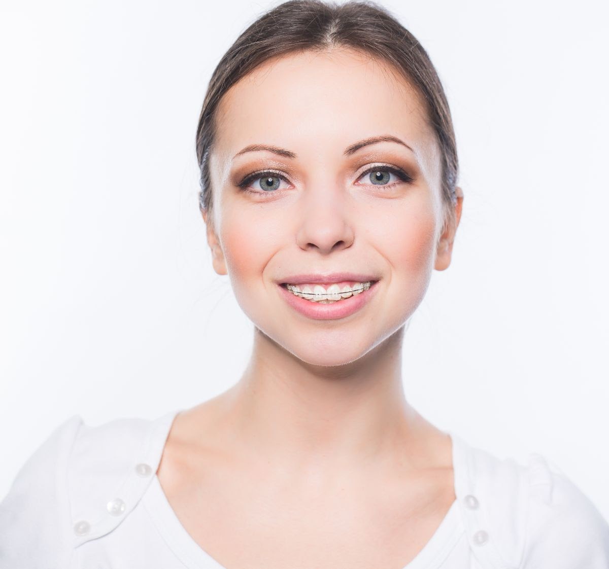 A Guide To Adult Orthodontic Treatment