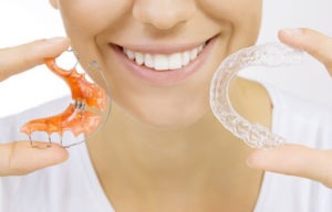 Everything You Need To Know About Retainers